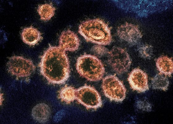 80% of the UK could catch Coronavirus
