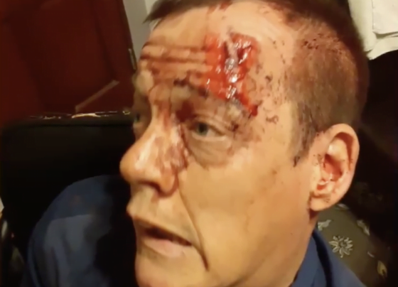 Repeat offender targets disabled man in Hull