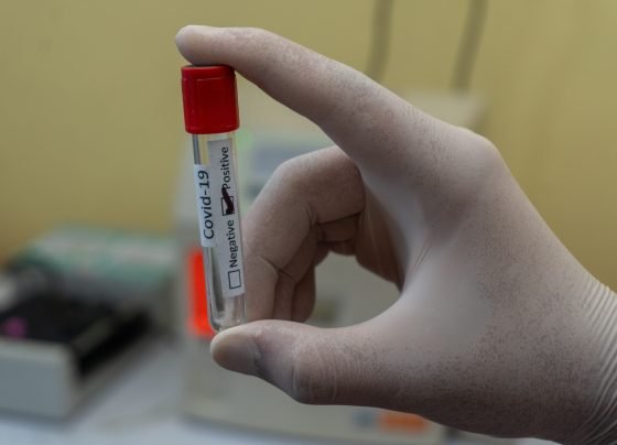 Positive Covid case vile